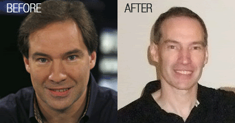 ted_forrest_before-after.gif